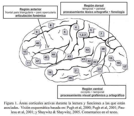 Gráfico comparativo entre el cerebro de un niño con dislexia y el de un niño sin dislexia, señalando las zonas cerebrales relacionadas con la lectura y la escritura.